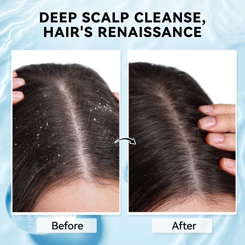 Mokasakiso Scalp Scrub dry scalp closeup emphasizes soothing hydration