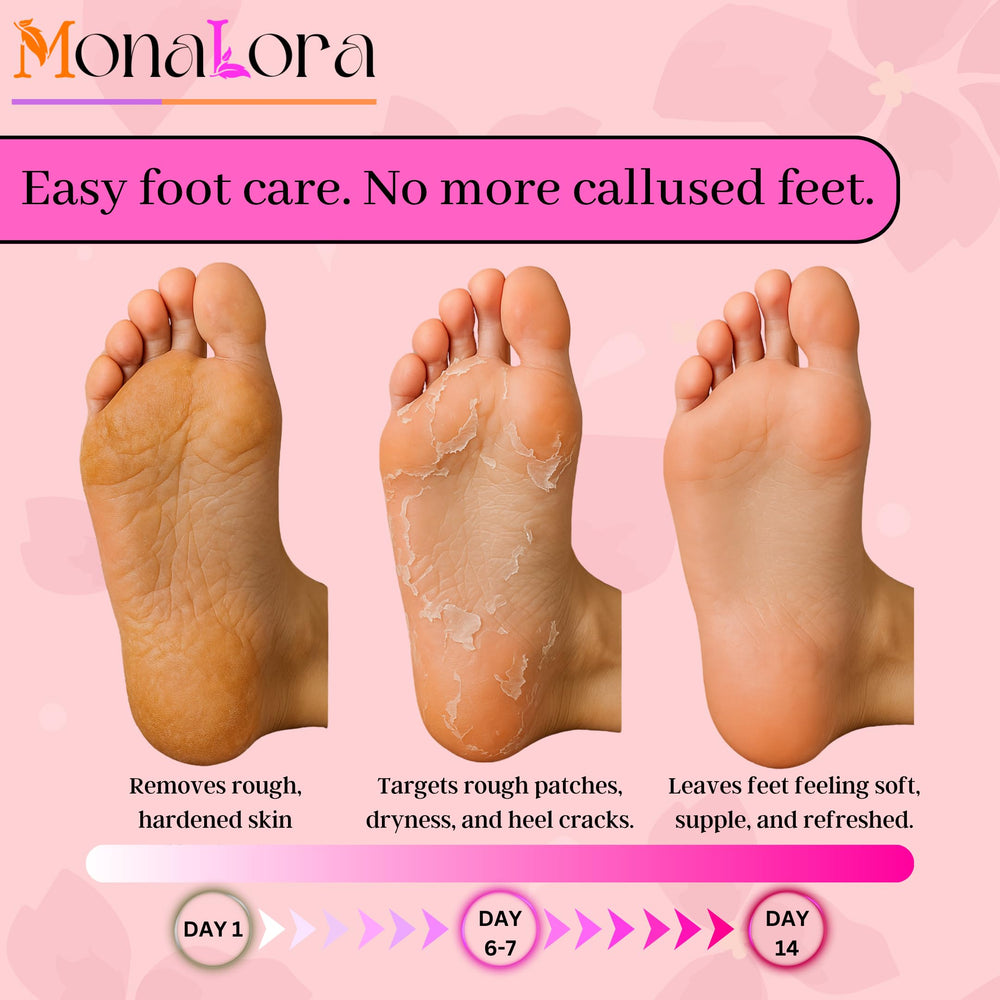 Application setup showing MonaLora booties on feet