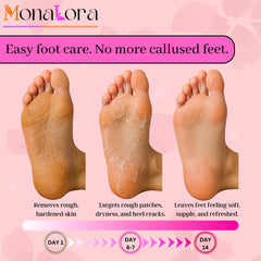 Application setup showing MonaLora booties on feet