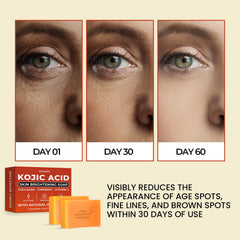 MONIER Kojic Acid Soap dark-spots-removal for brighter skin and smoother texture.