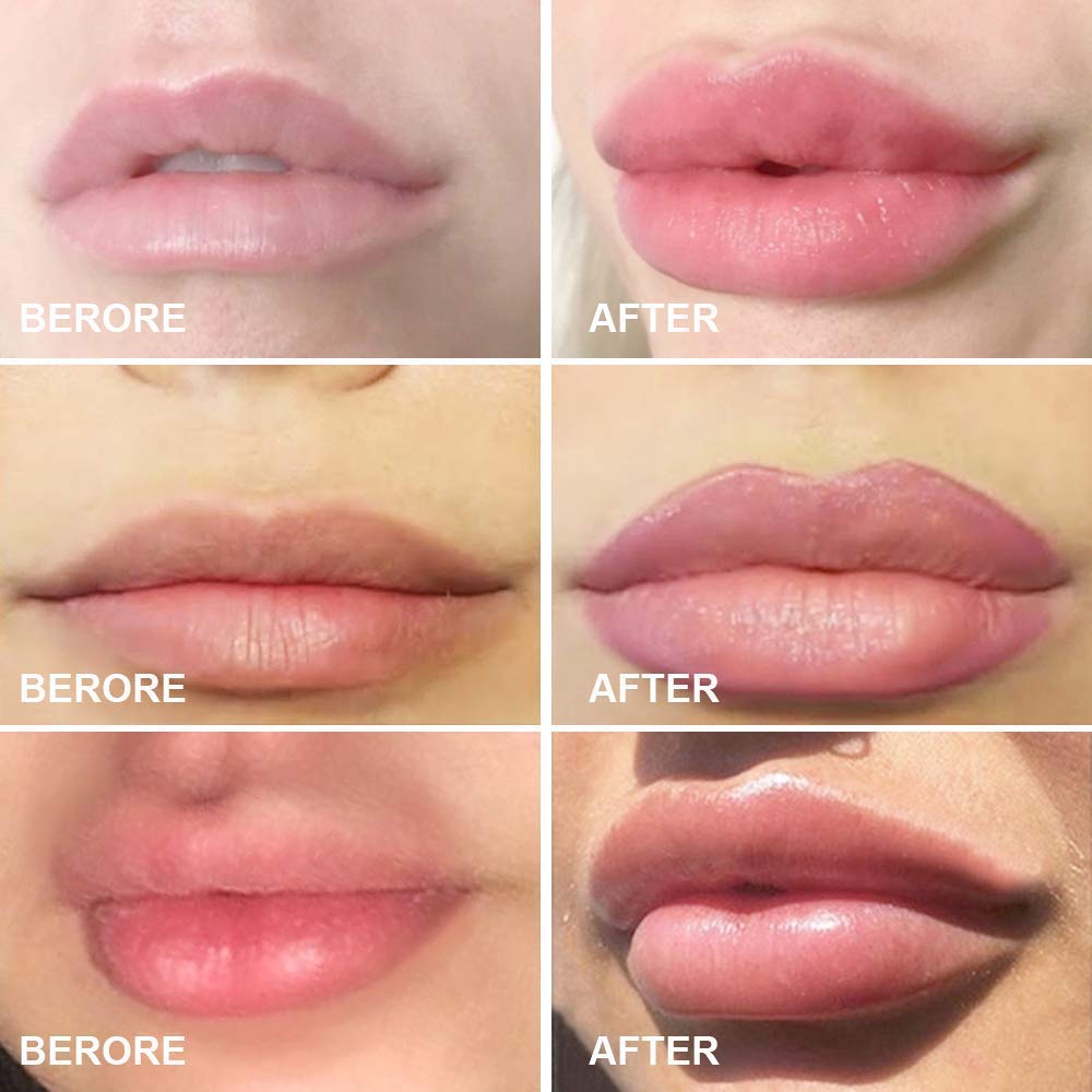 MonLiya time-limits reminder supports safe, short plumping sessions