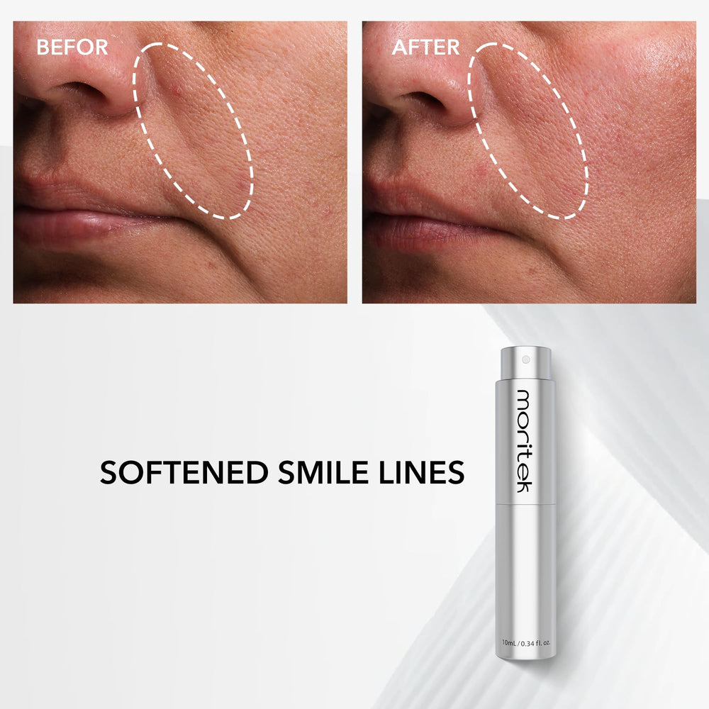 MORITEK Ultimate Mori-Lift Mist xep-018 highlight visibly relaxed micro-movements for smoother skin.