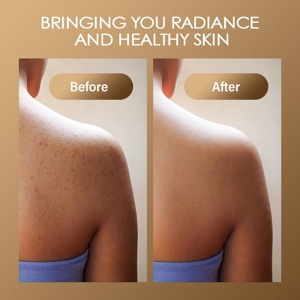 MOSRROU Turmeric Scrub ingredients image highlighting turmeric and vitamin C for radiant look.