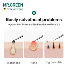 MR.GREEN ergonomic curved-tail tweezers provide comfortable grip during precise grooming tasks.