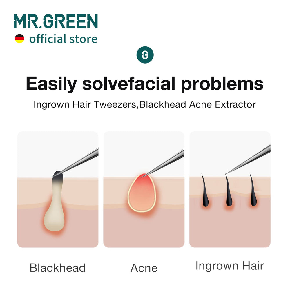 MR.GREEN needle nose tweezers close-up for splinter removal precision.