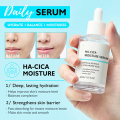 MrCuvaryas hyaluronic acid hydration panel demonstrates plump, hydrated skin