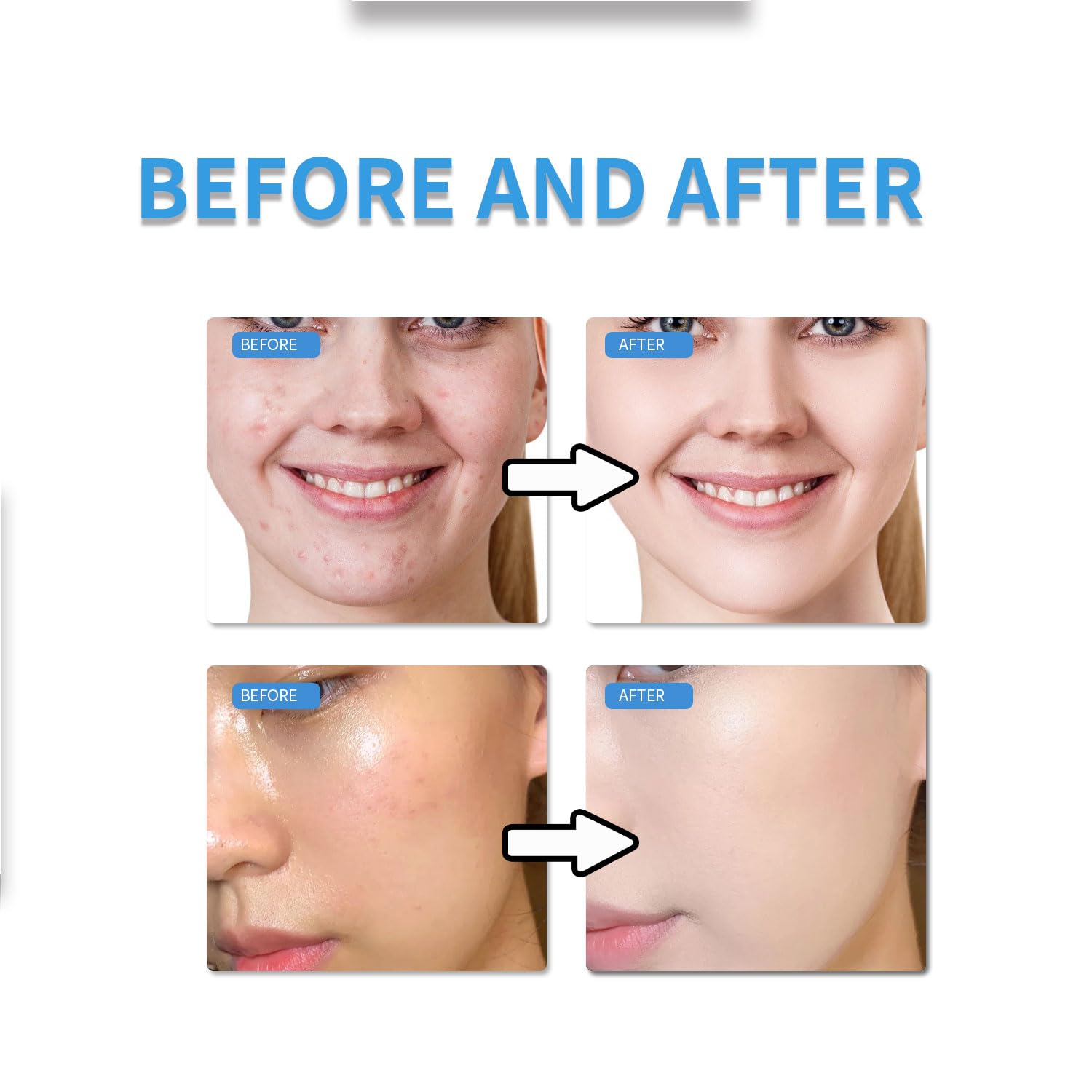 MTMULT Soft radiant skin close-up showcasing refreshed, comfortable complexion.