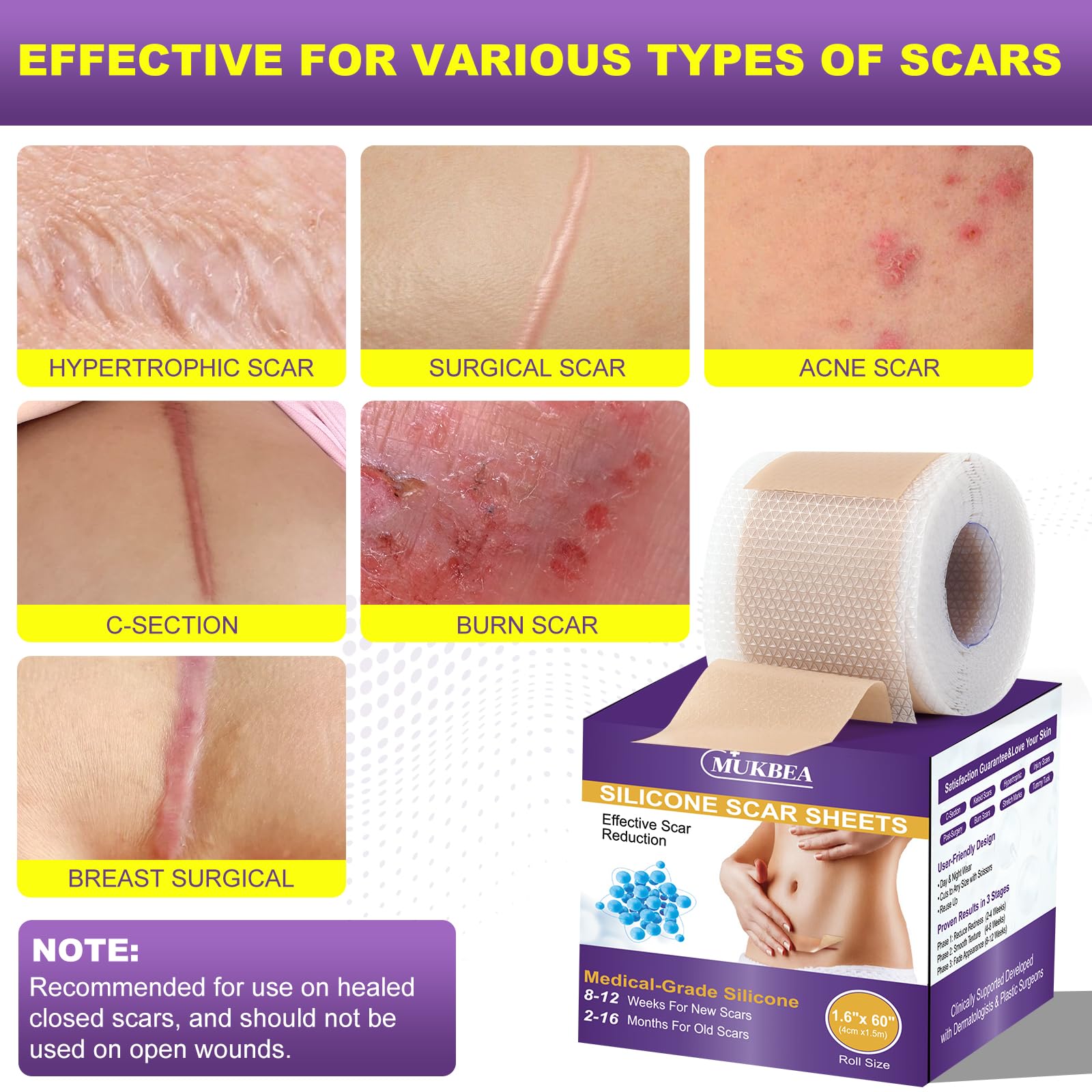 MUKBEA silicone scar tape cut-to-fit demonstrates easy customization for scar size