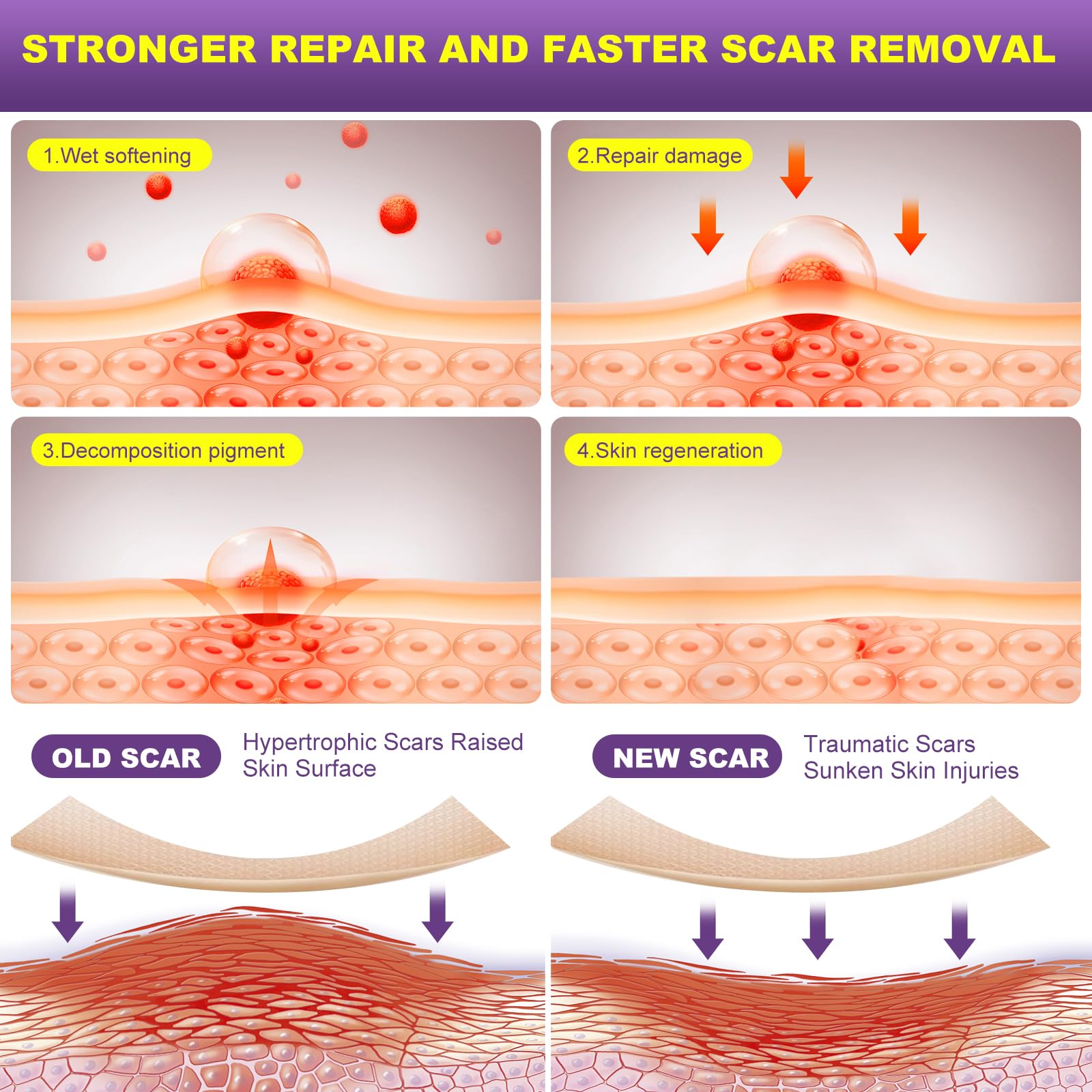 MUKBEA silicone scar tape on skin illustrates gentle, low-friction protection during daily activity
