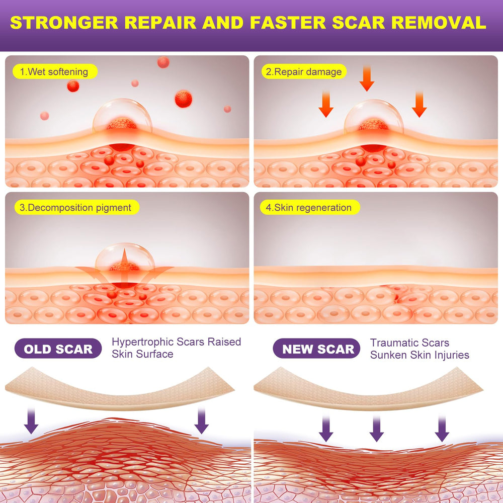MUKBEA silicone scar tape on skin illustrates gentle, low-friction protection during daily activity
