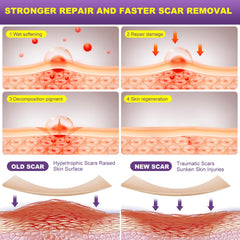 MUKBEA silicone scar tape on skin illustrates gentle, low-friction protection during daily activity