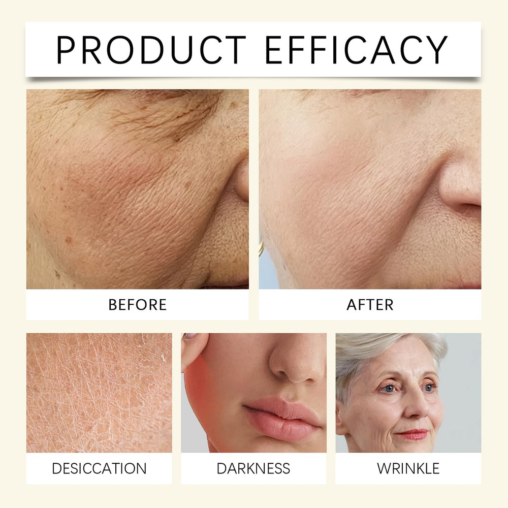 MUOCOBU balm in use on dry skin areas