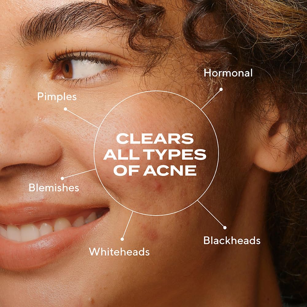 Murad Biome-Balancing Acne Serum pump-dispense enables precise, controlled daily application.