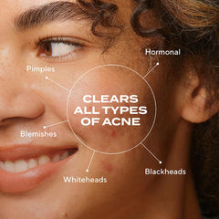 Murad Biome-Balancing Acne Serum pump-dispense enables precise, controlled daily application.