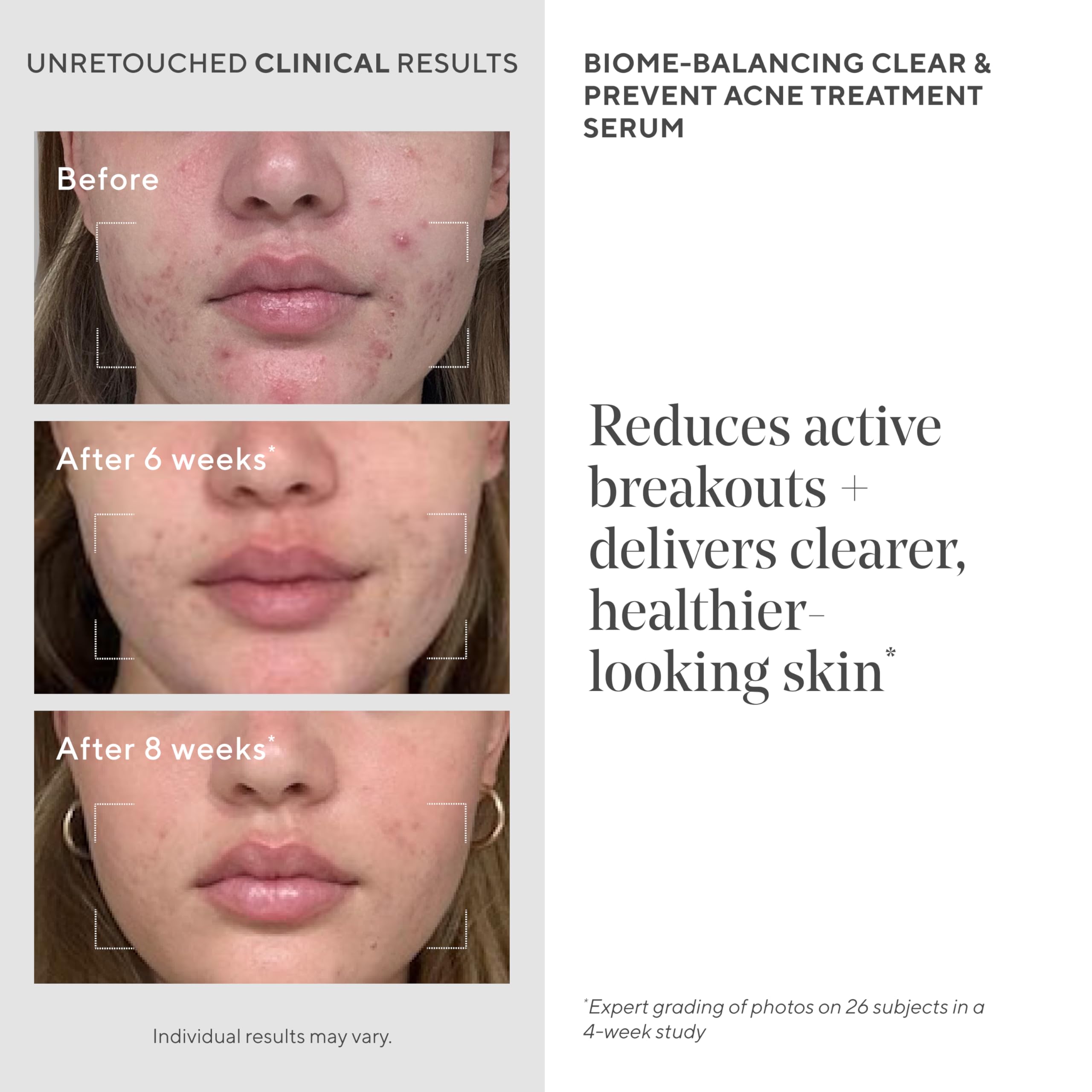 Murad Biome-Balancing Acne Serum texture closeup reveals lightweight, non-greasy feel.