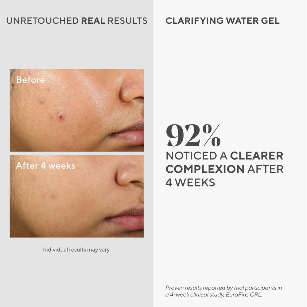Murad Clarifying Water Gel texture during application for shine-free hydration.