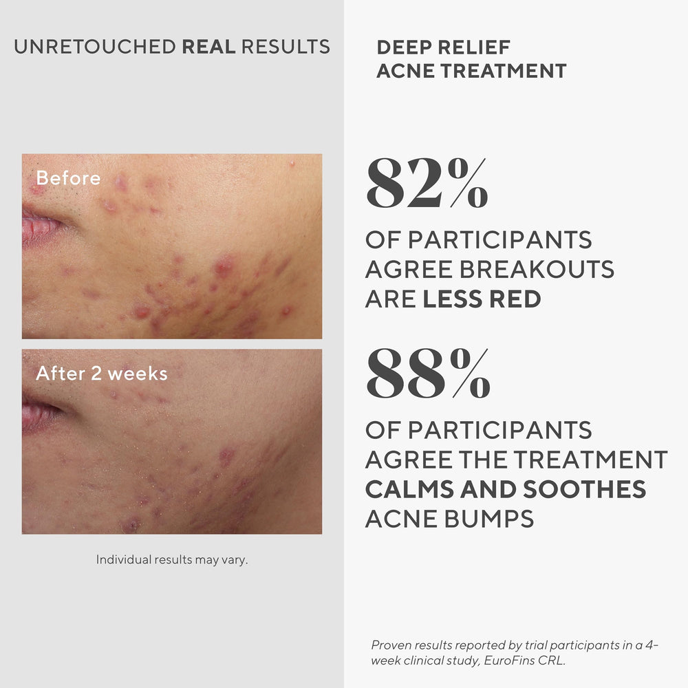 Murad Deep Relief packaging shows dermatologist-developed spot treatment claims.