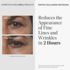 Murad Rapid Collagen Infusion on neck and chest for firmer, smoother skin.