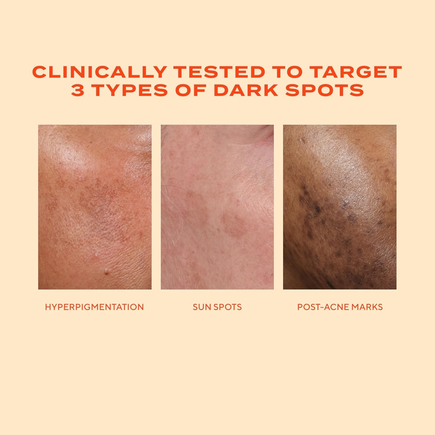 Resorcinol ingredient emphasis supports targeting dark spots while maintaining product focus.