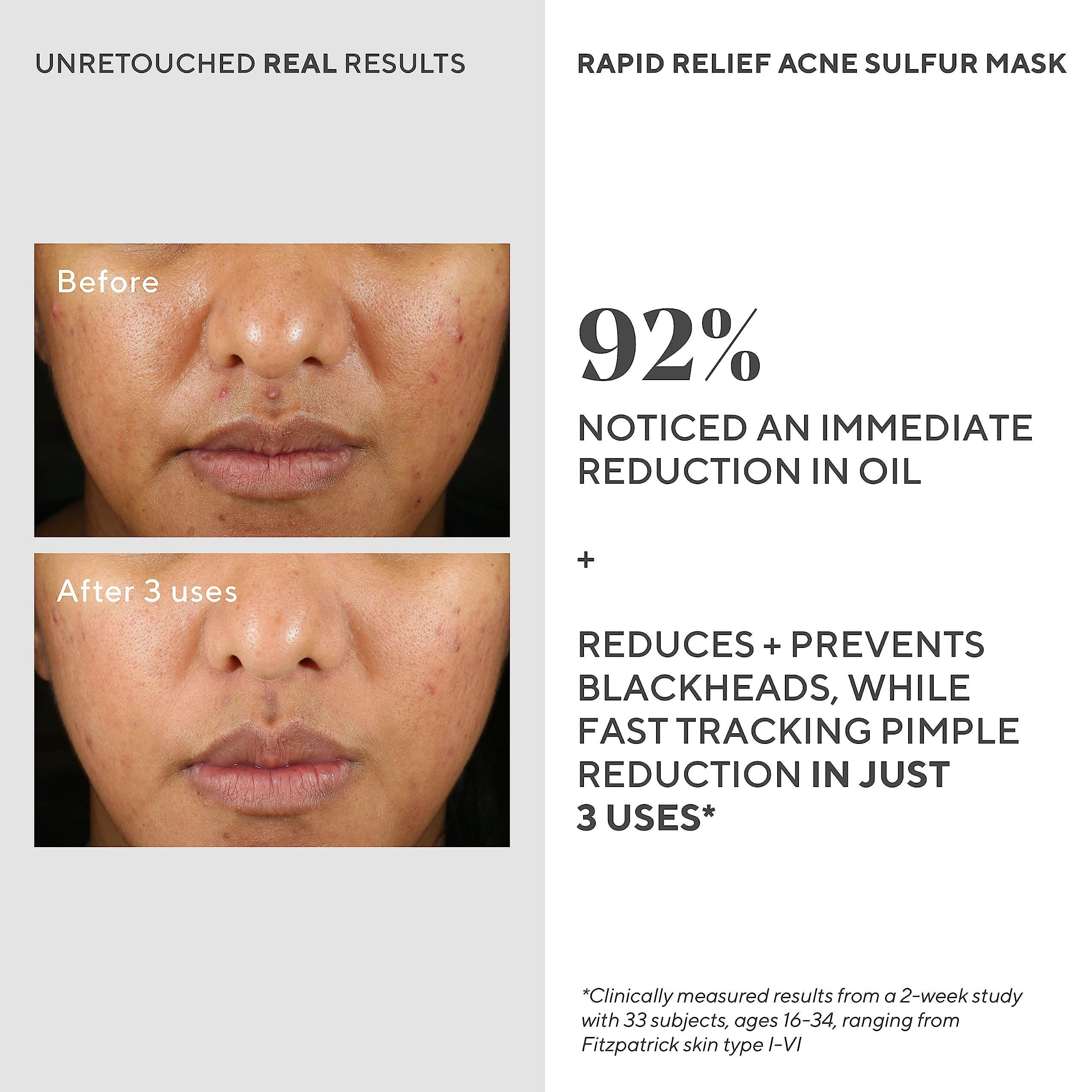Murad Rapid Relief kaolin clay purifies pores for clearer skin