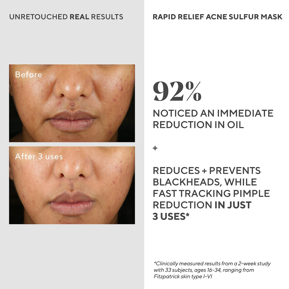 Murad Rapid Relief kaolin clay purifies pores for clearer skin