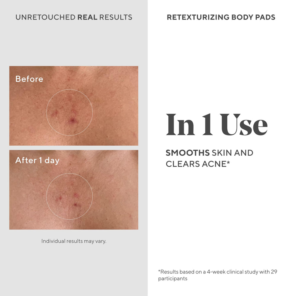 Murad Retexturizing Body Pad applied to forearm for acne-prone skin