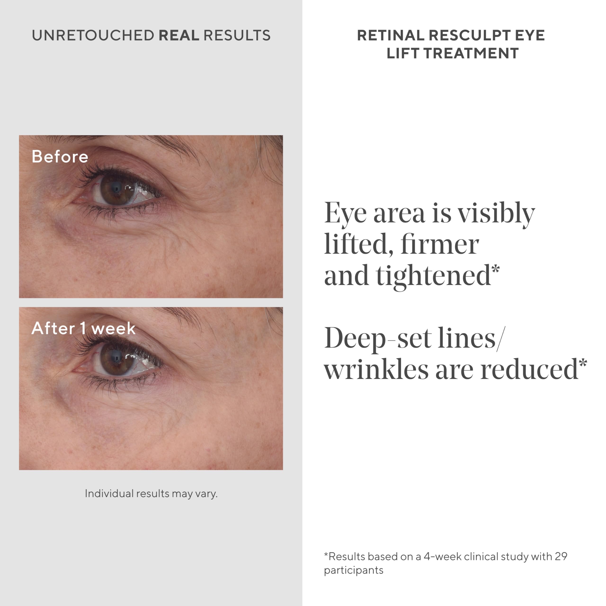 Creamy texture and encapsulated retinal detail in Murad formula