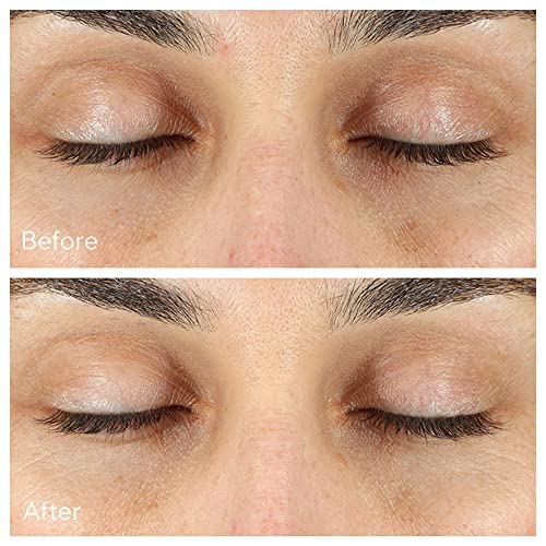 Murad Vita-C Eyes algae extract highlights nourishing under-eye care and hydration.