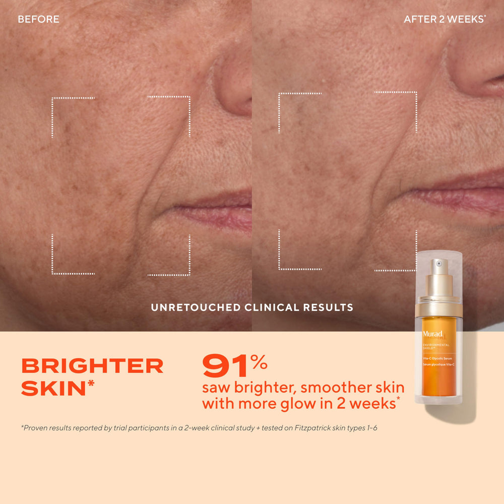 Murad Vita-C Glycolic Serum ingredients close-up featuring gold-stabilized Vitamin C