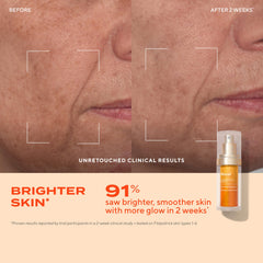 Murad Vita-C Glycolic Serum ingredients close-up featuring gold-stabilized Vitamin C