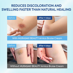 Murasaki Beauty Arnica ingredients close-up featuring arnica and vitamins for skin support.