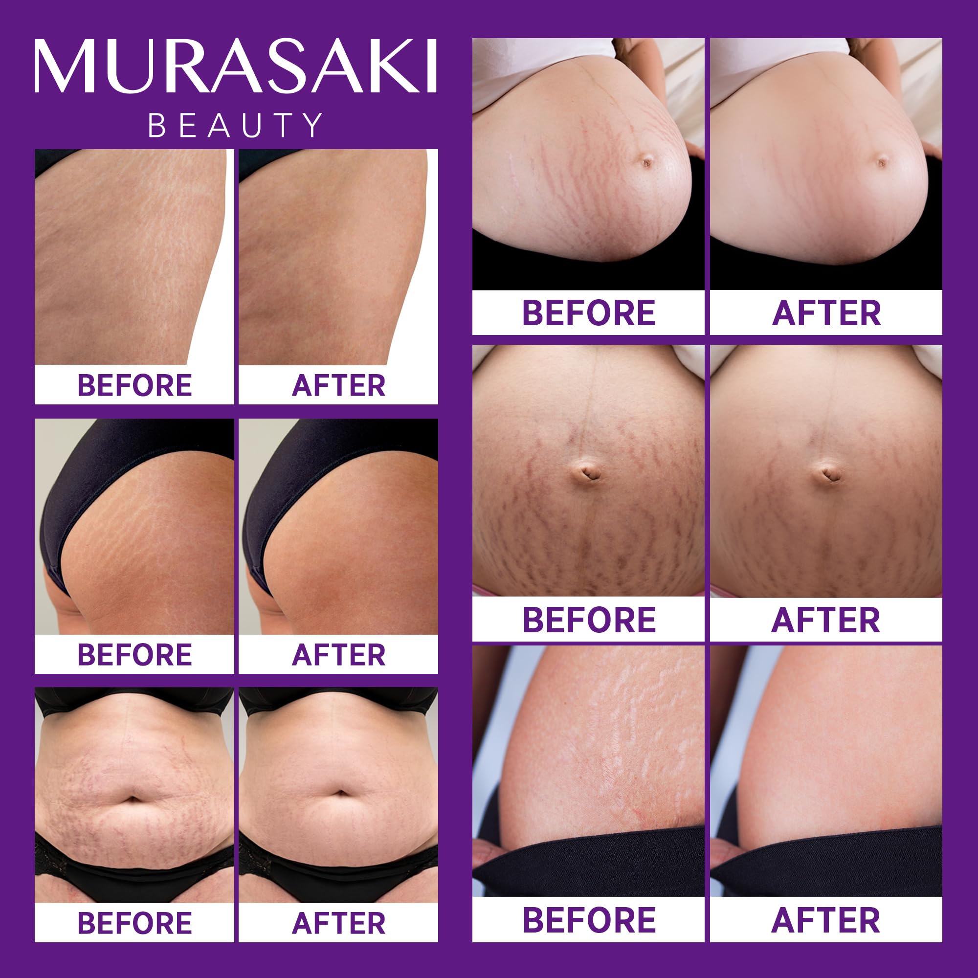 Murasaki Beauty hyaluronic acid close-up highlights deep hydration for skin resilience.