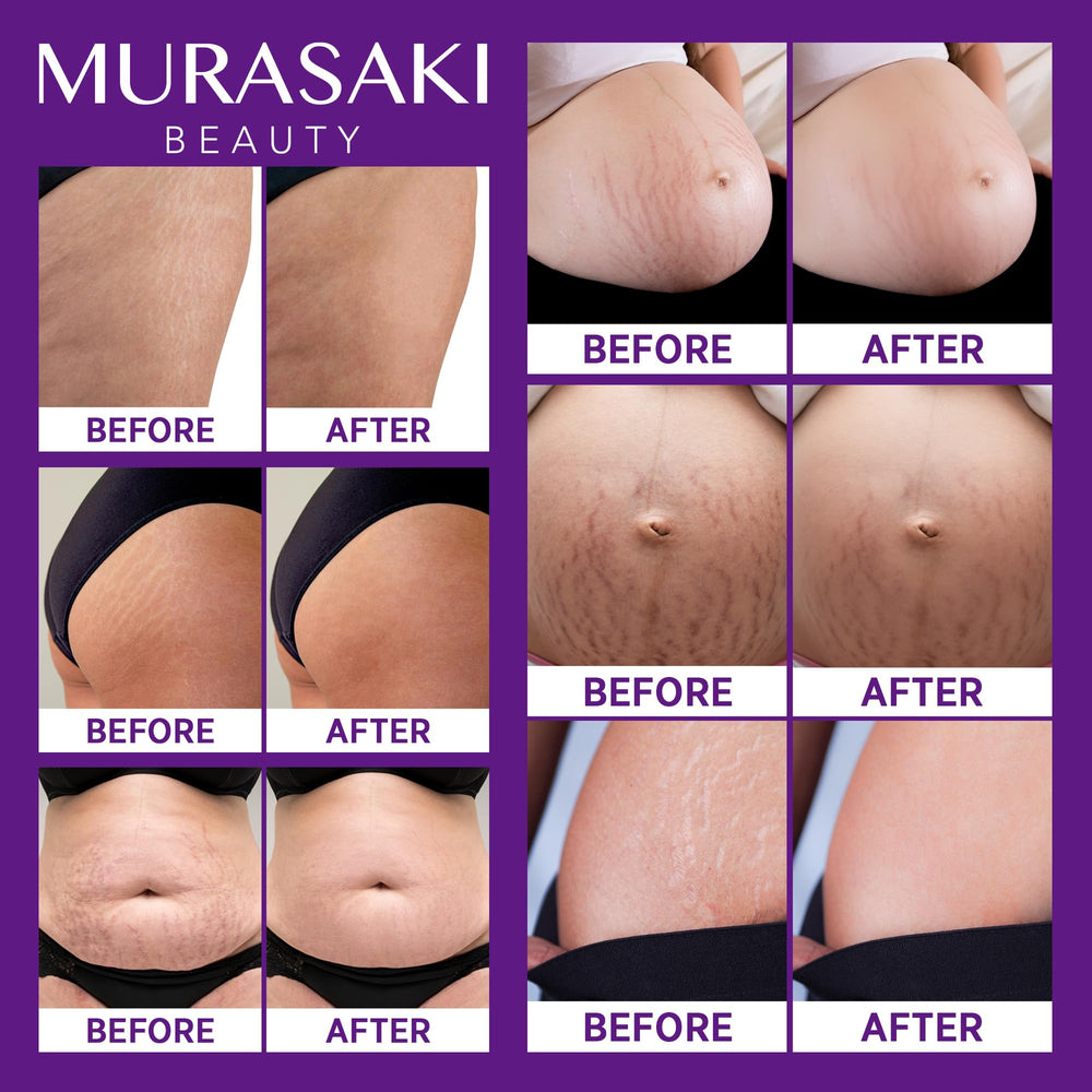 Murasaki Beauty hyaluronic acid close-up highlights deep hydration for skin resilience.