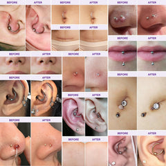 MURASAKI BEAUTY keloid bump gel applying on skin for scar repair and soothing relief.