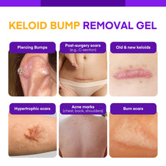 MURASAKI BEAUTY keloid bump gel close-up texture, light and non-greasy for sensitive skin.