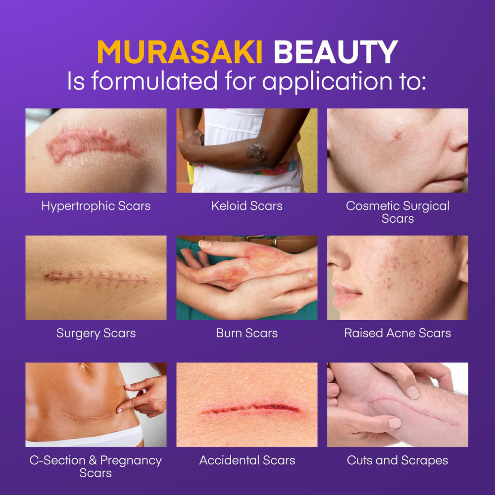 MURASAKI BEAUTY silicone scar gel SPF 30 label highlighting sun protection