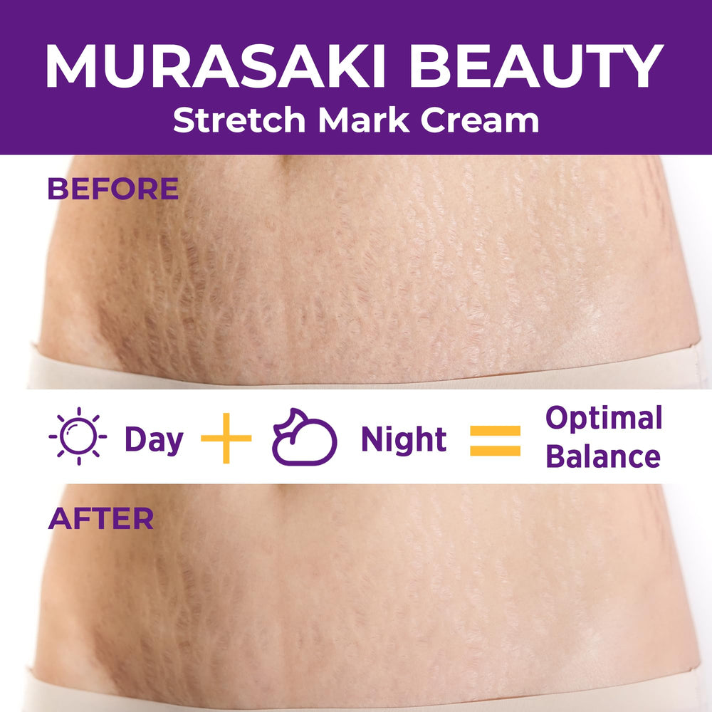 Murasaki Beauty stretch-mark-cream-application-abdomen demonstrates soothing, preventive skincare during pregnancy.