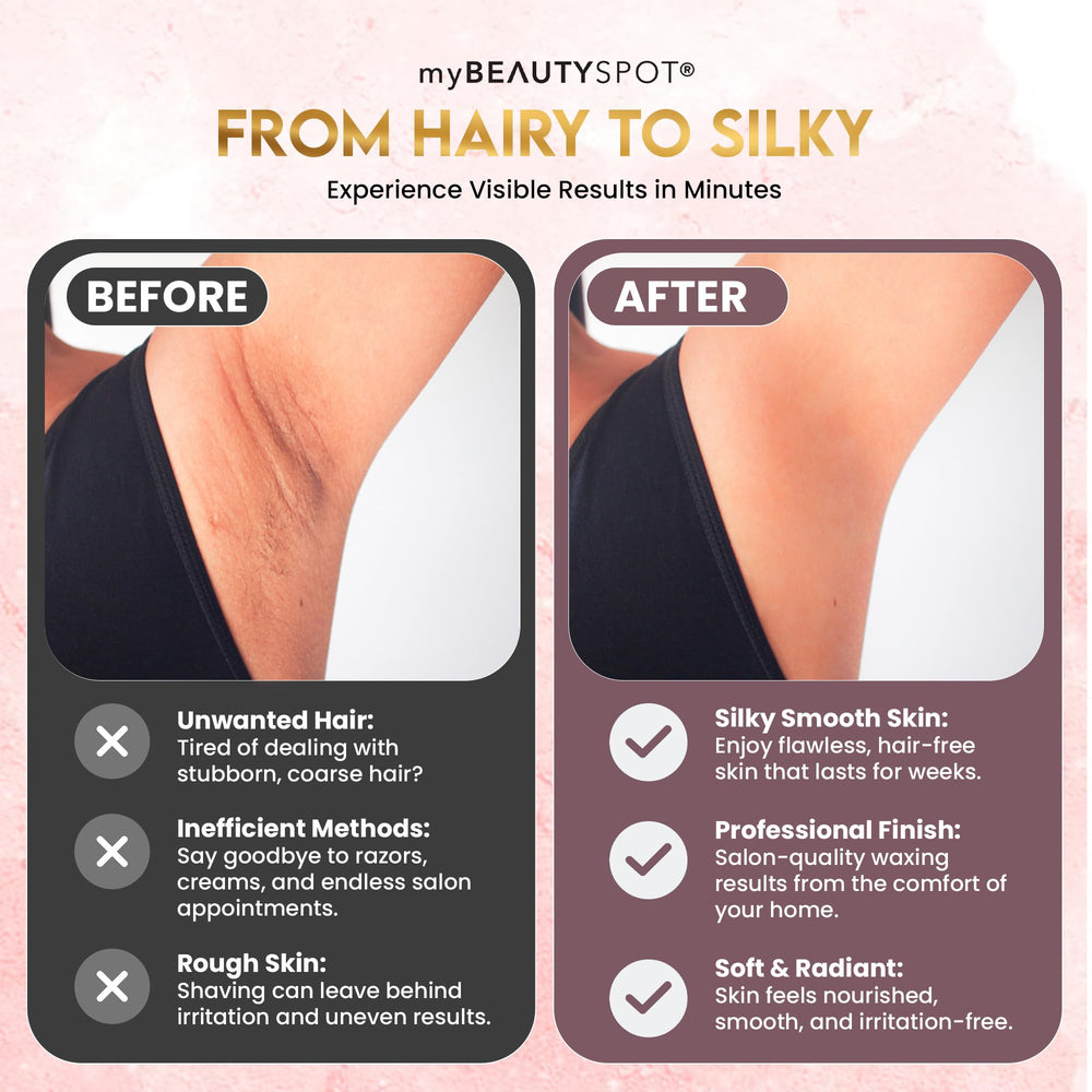 My Beauty Spot no-mess, stress-free at-home waxing experience.