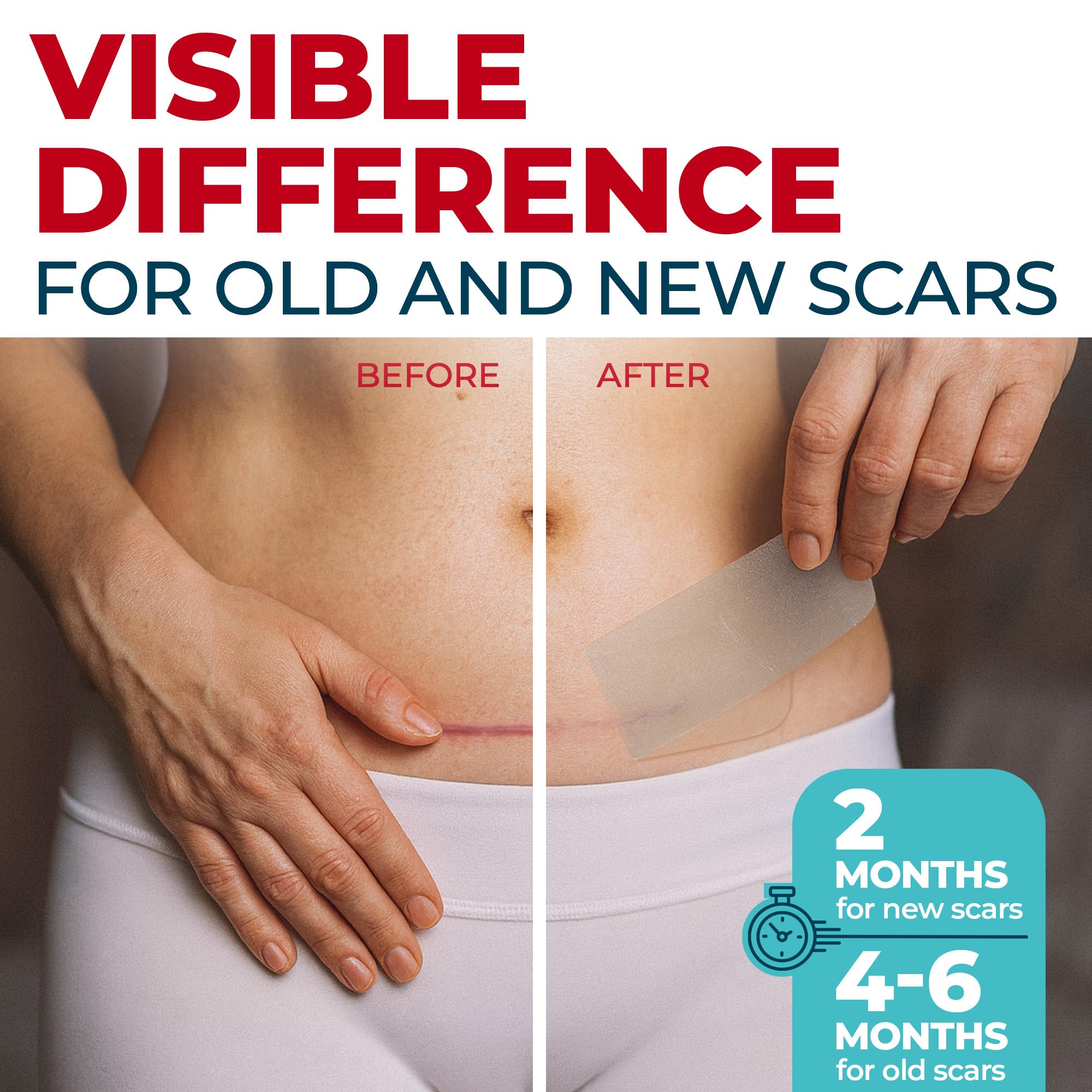 MYHELP silicone scar tape adhesive close-up shows hypoallergenic bond for secure wear.