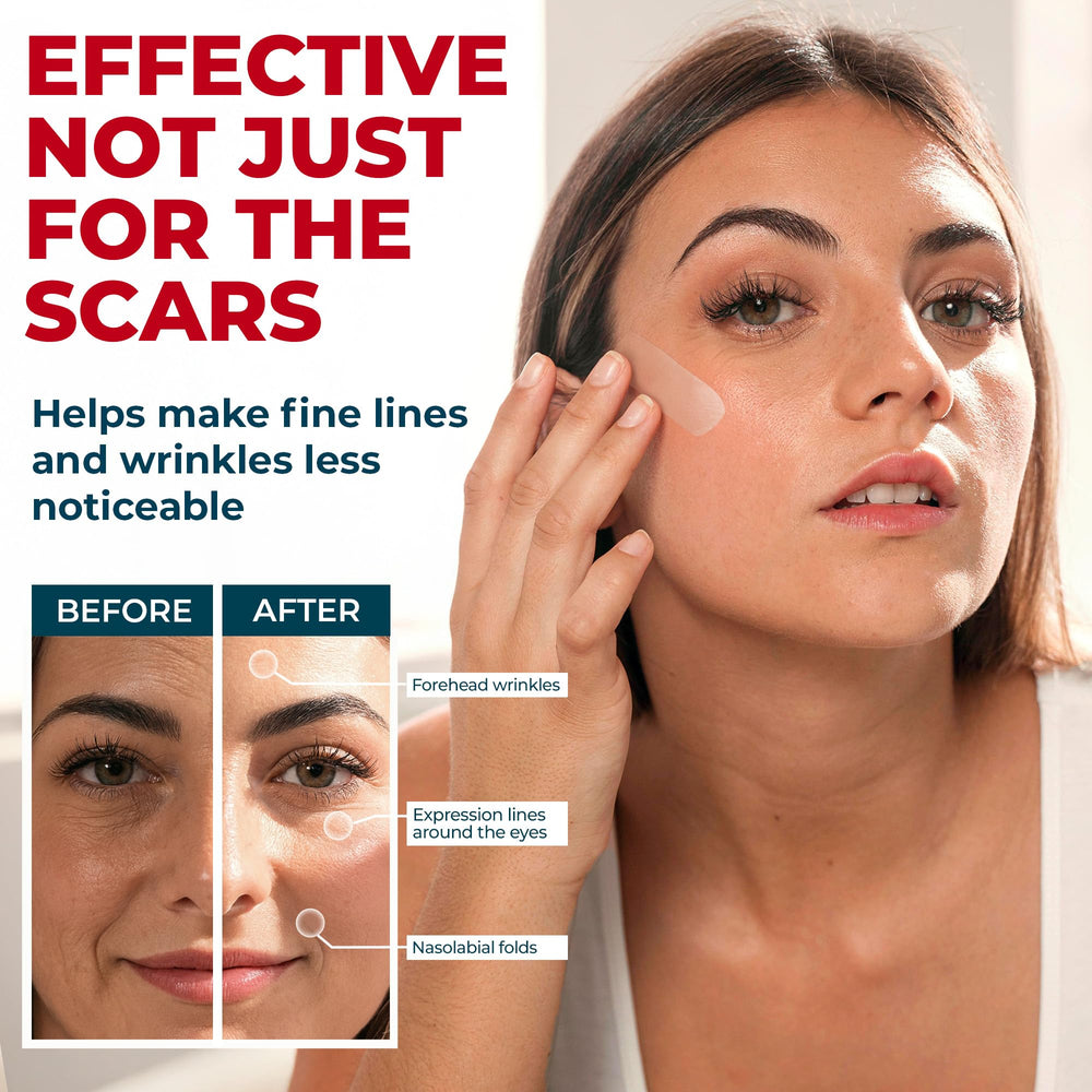 MYHELP extra-long silicone scar tape roll for large areas.