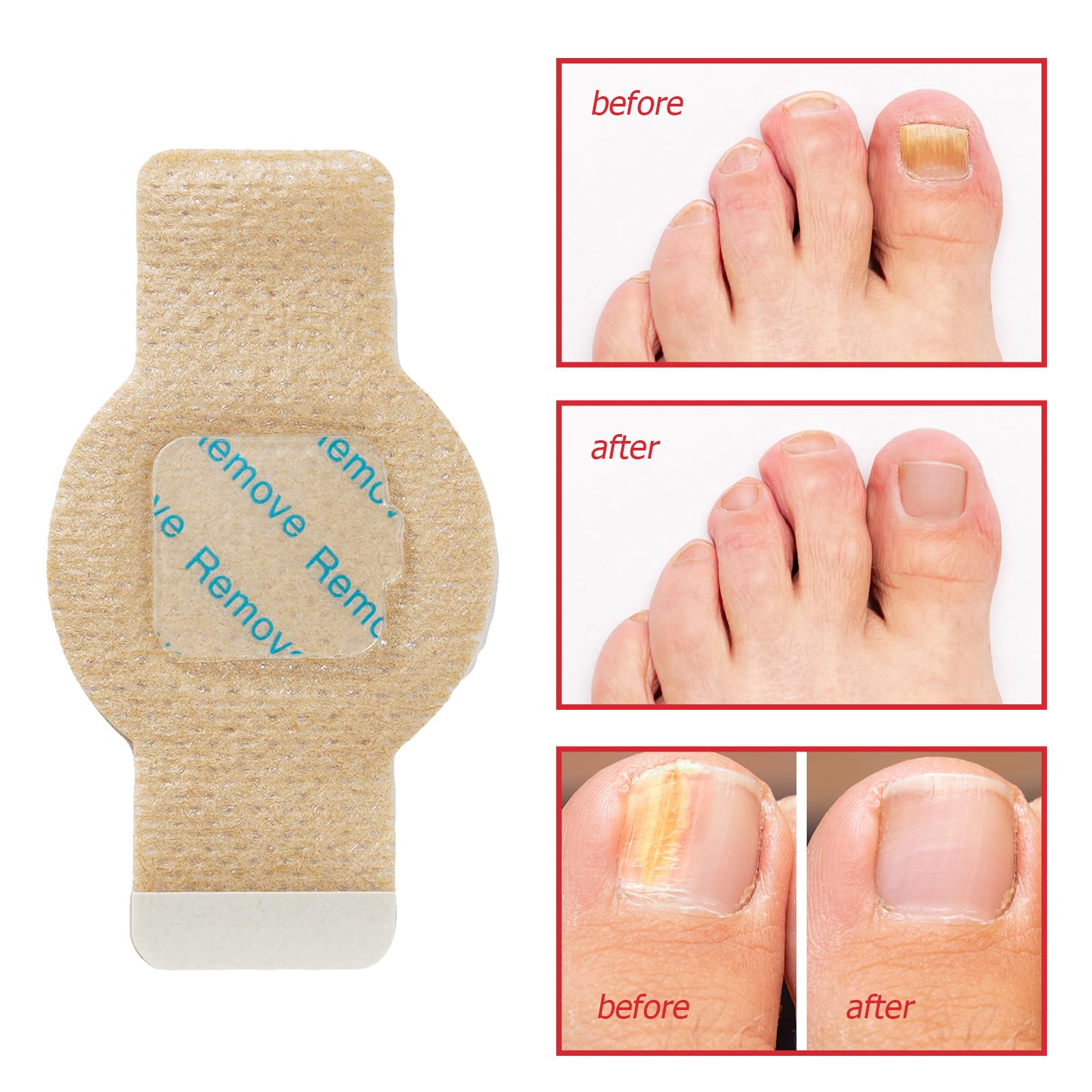 Nail Patches damaged-nails-repair emphasizes potential improvement in discoloration and texture.