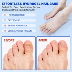 Nail Patches healthy-nails closeup showing restoration and natural shine