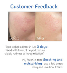 Nano Recipe D-Panthenol drops being added to skincare routine for moisture.