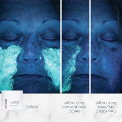 NassifMD Exfoliating Detox Pads in use for glowing skin effects.