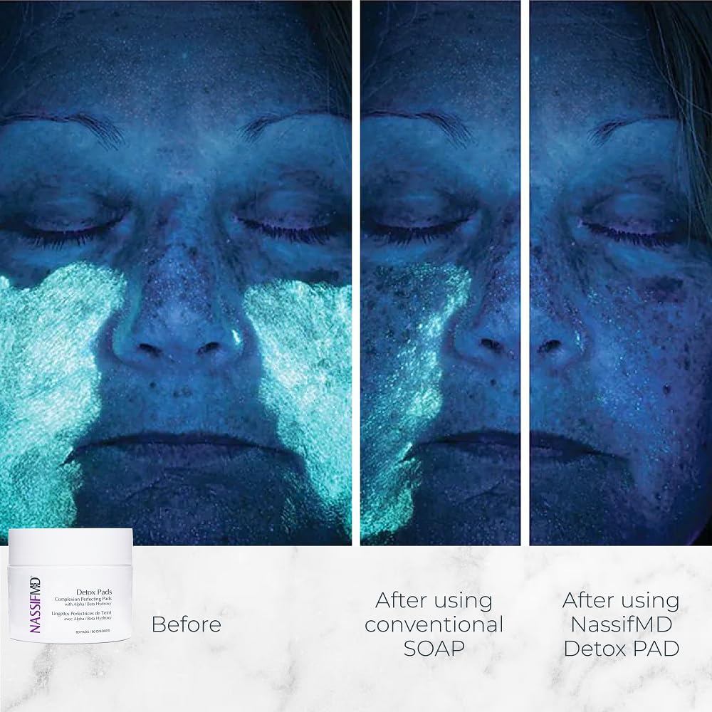 NASSIFMD Exfoliating Detox Pads open showcasing the pads ready for use.