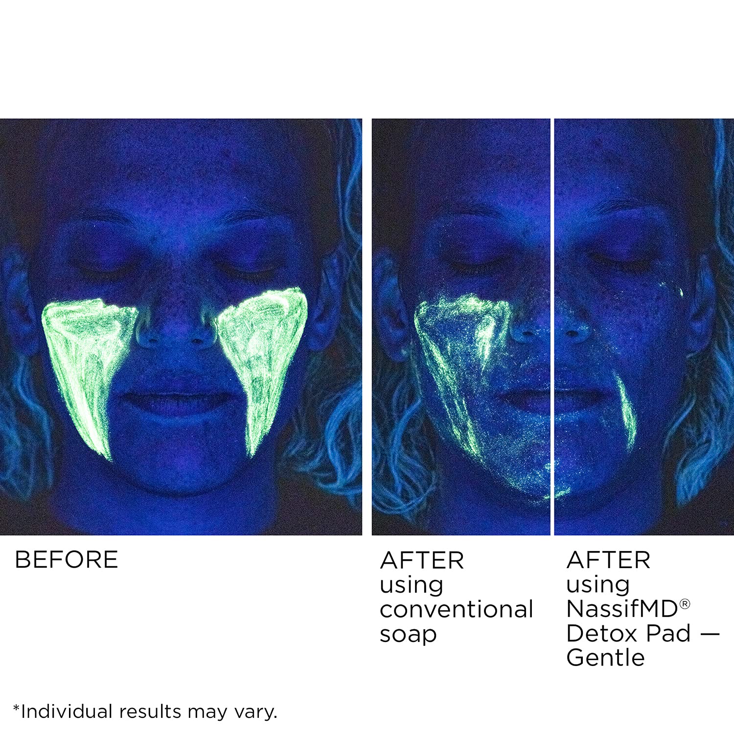 NassifMD detox pads ingredient panel featuring glycolic acid, lemon, and vitamin C for detox and brightening.
