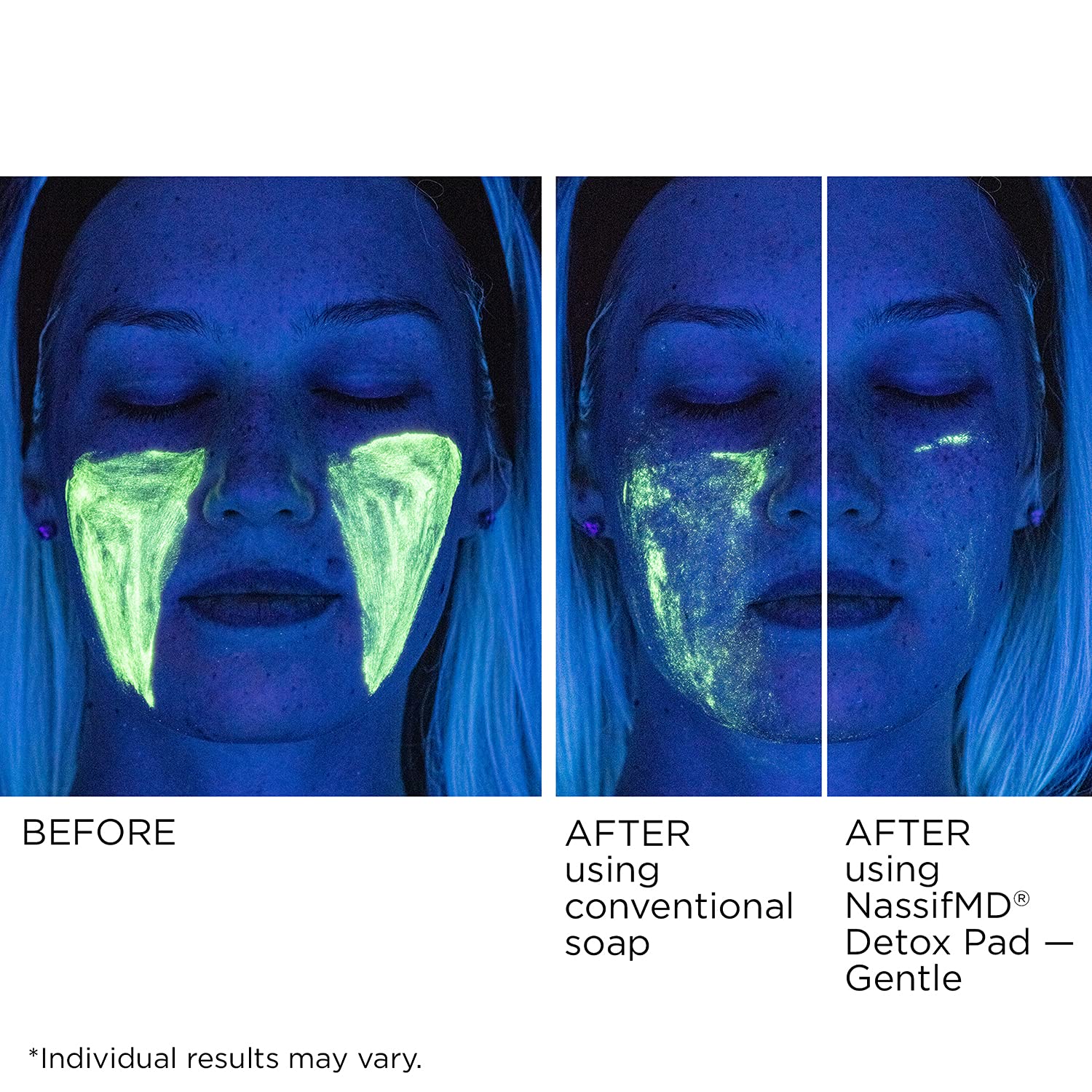 NassifMD formula with hyaluronic acid to boost moisture retention for smoother skin.