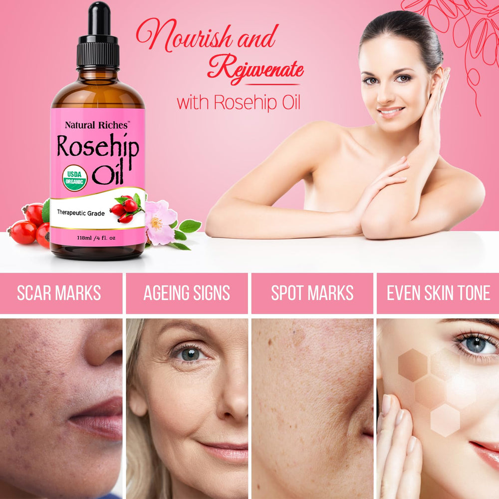 Natural Riches rosehip oil in use on face shows gentle hydration