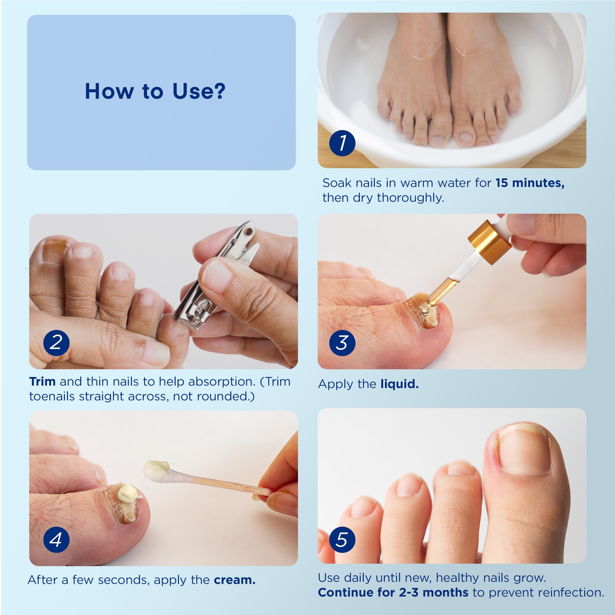 Natural Vine Nail Repair Cream 20g pictured for supporting skin comfort.