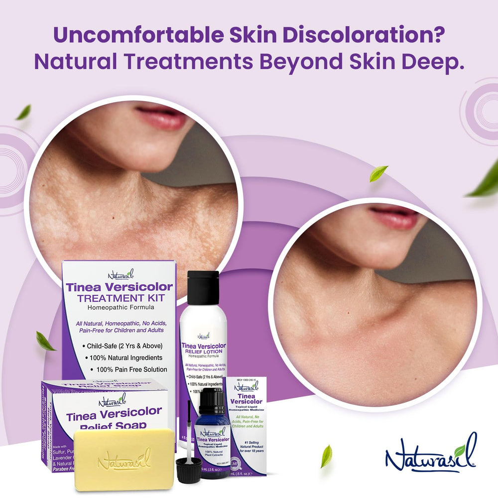 Naturasil tinea versicolor soap bars pack-front highlights a convenient two-bar kit for home use.